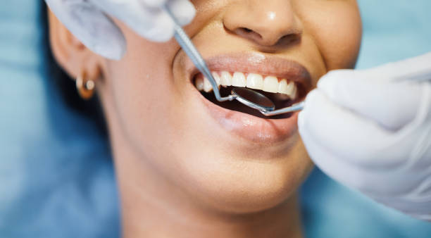 Best Emergency Treatment for Dental Infections or Abscesses in Lake Barcroft, VA